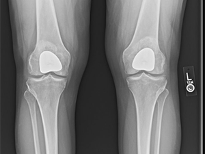 Knee Icon