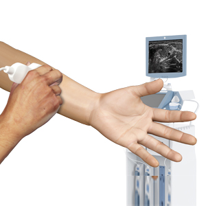 Musculoskeletal Ultrasound
