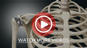 Patient Education Videos