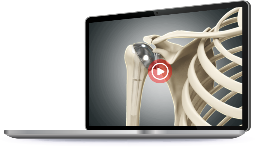 Patient Education Videos & Resources