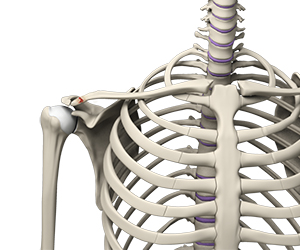 Clavicle Fracture - Educational Picture