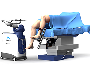 Robotic Assisted Total Knee Replacement - Educational Picture