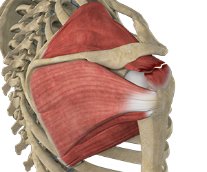Rotator Cuff Tear - Educational Picture