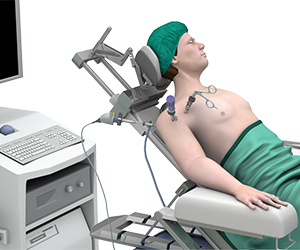 Shoulder Arthroscopy - Educational Picture