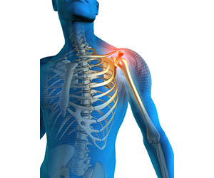 Shoulder Pain - Educational Picture