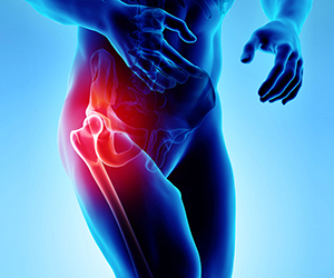 Hip Pain - Hip