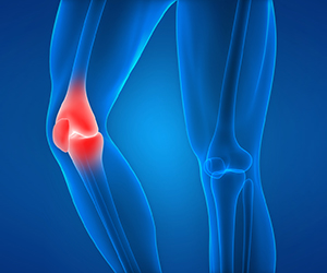 Knee Injury - Knee