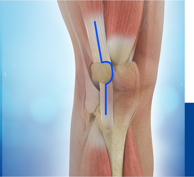 Muscle Sparing