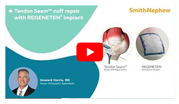 picture of TENDON SEAM Rotator Cuff Repair System