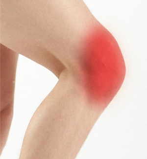 Knee Pain Img