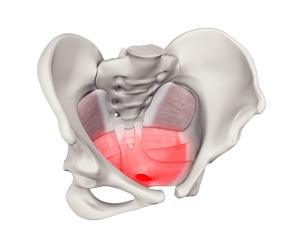 Pelvic Floor Pain Img