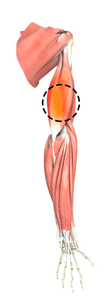 Triceps Pain Img