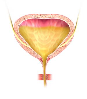 Urinary Incontinence Img