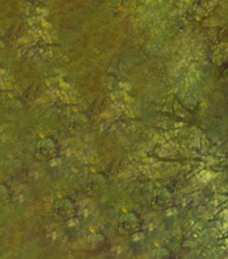 PURIST Assisted DAA Hip Replacement Left