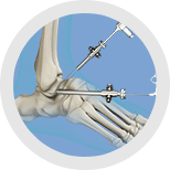 Img-Sports Injuries