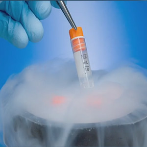 Picture of Stem Cell Banking