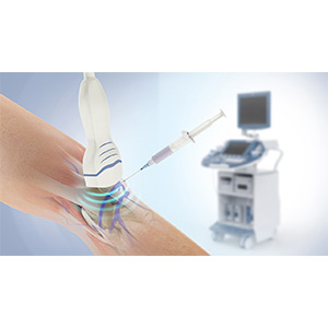 Ultrasound Guided Injections