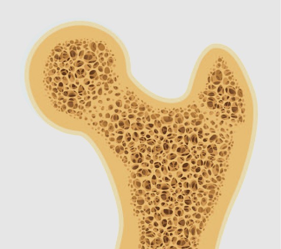 Bone Marrow Concentrate (BMC+) cellular therapy