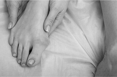 Hallux Valgus causes and treatment options