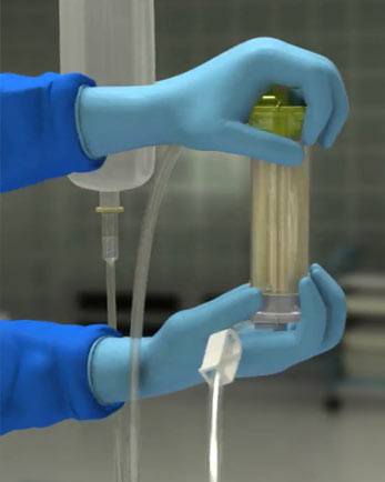 Picture of Gently Processing Your Fat Using Saline