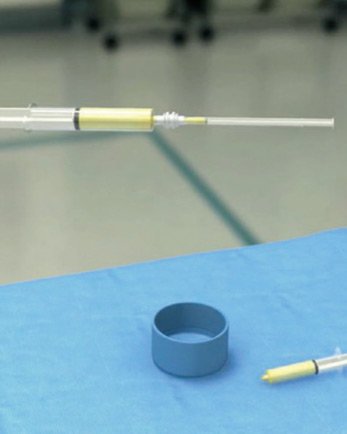 Picture of Lipogems Is Delivered Into The Body Areas