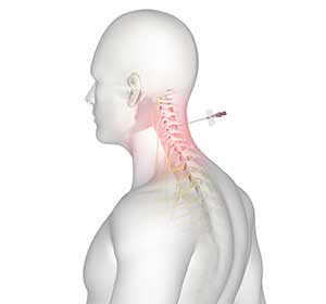 Spine