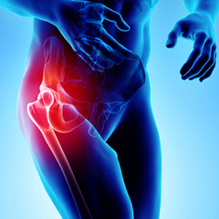 Robotic-Guided Total Hip Replacement