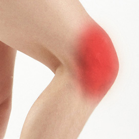Anterior Knee Pain Image