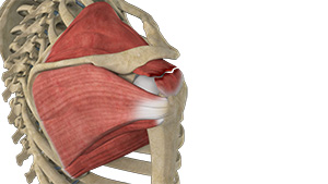 Rotator Cuff Tear