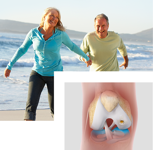 Autologous Chondrocytes Implantation (MACI)