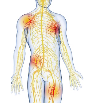 Neuropathy and Neuritic Pain