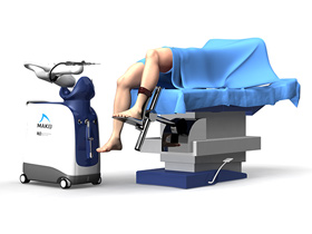 Robotic Assisted Knee Replacement img