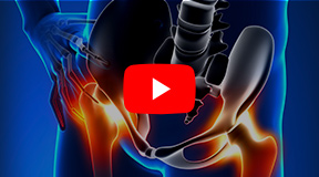 Patient Education Video