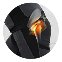 Knee Images