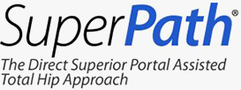 Superpath Hip Replacement