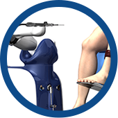 Mako SmartRobotics for Total Knee Replacement Images