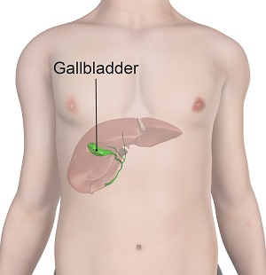 Gallbladder Surgery pic