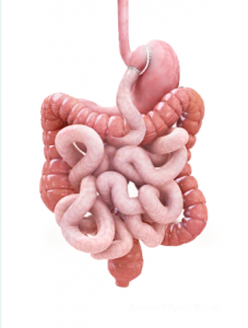 Laparoscopic Roux-En-Y Gastric Bypass(with and without fixed gastric ring) pic