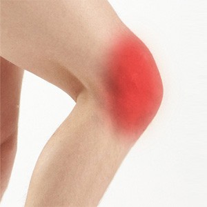 Picture of Anterior Knee Pain