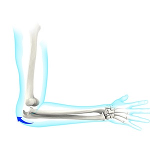 Picture of Elbow Dislocation