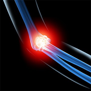 Picture of Elbow Injuries