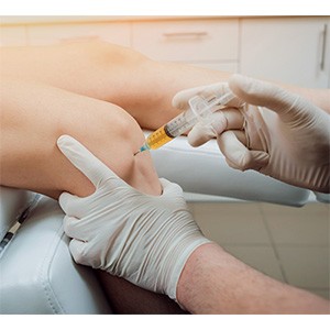 Picture of PRP Injections