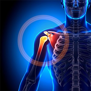 Picture of Shoulder Disorders