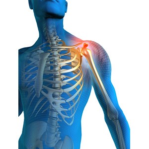 Picture of Shoulder Pain