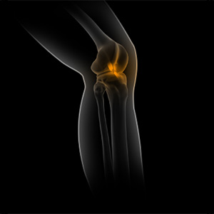 Picture of Sports Medicine