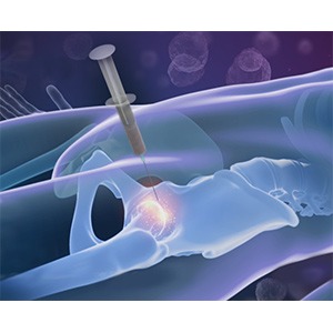 Picture of Stem Cell Therapy