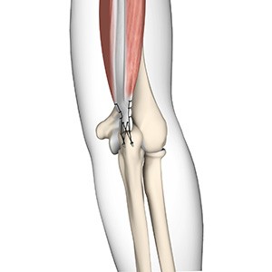 Picture of Triceps Repair