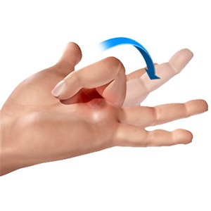 Picture of Trigger finger