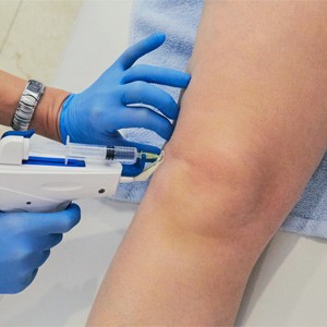 Picture of Zilretta Injections