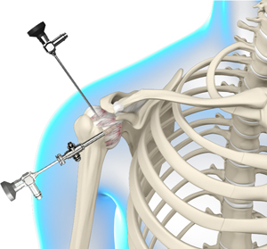 Arthroscopic Surgery-img